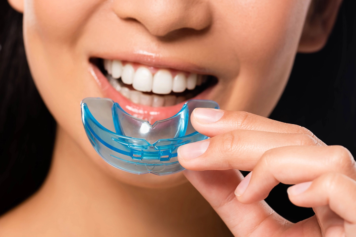 Mouthguards at Dr. Sunit Jain Dental Care